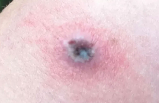 Koronavirüs bitmeden 'Alaska çiçeği' salgını patlak verdi: Hayvanlardan bulaşıyor!