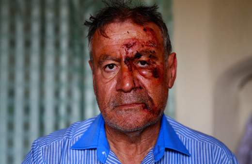 Kayseri'de minibüs şoförü "sefer saatine geç kaldığı" iddiasıyla darbedildi