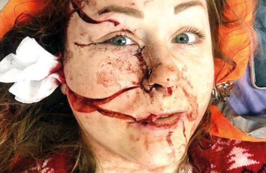 İstanbul'da eşinin yüzünü falçatayla doğradı mahkeme iyi hal verdi