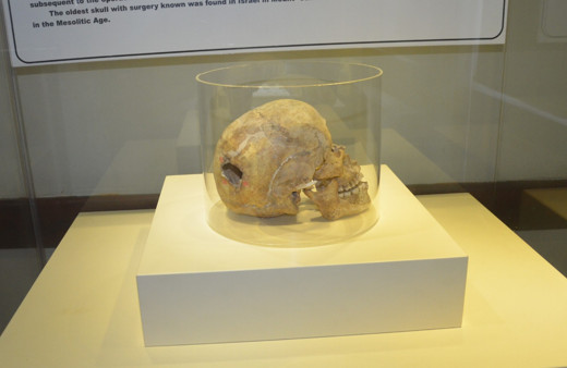 Samsun'da 3 bin yıllık kafatası bulundu! Üzerindeki izi gören şaştı kaldı