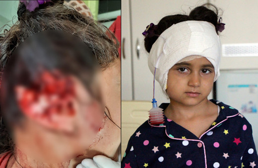 Düzce'de 5 yaşındaki kız kabusu yaşadı! 300 dikiş atıldı: 4 saat 40 yıl gibi geldi