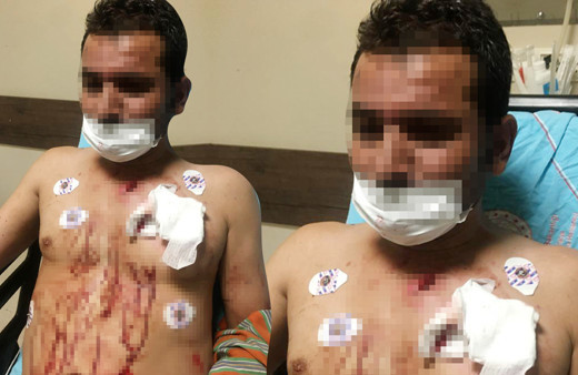 Antalya'da uygunsuz fotoğrafları gören kadın çılgına döndü! Sevgilisini kanlar içinde bıraktı