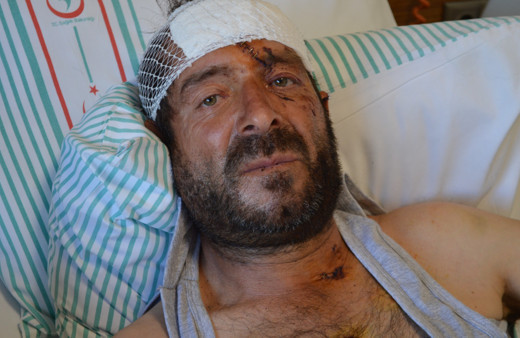 Tunceli'de kabusu yaşadı kanlar içinde kaldı: Beni ayı parçaladı, hemen milleti topla