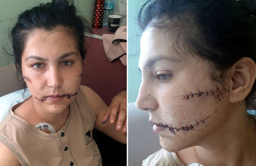 Eşinin 104 yerinden bıçakladığı Aysel isyan etti: Pencereye dahi çıkamıyorum