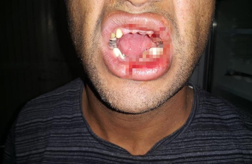 Şanlıurfa'da aşı yaparken bu hale geldi: Ölümden döndü, yatağa bağlı bir halde yaşıyor