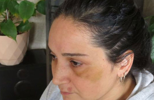 Üsküdar'da boşanma davası açtığı kocası kabusu yaşattı! Darbetti, otomobilini yaktı, tehdit etti