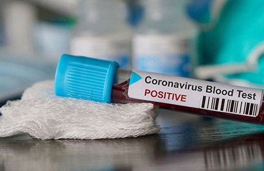 ABD'de ilk Omicron varyantı vakasına rastlandı