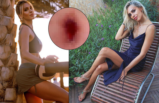 'Korkunç bir facia yaşadım' dedi! TV8 Survivor Duygu Bal saldırıya uğradı: Kanlar içinde kaldı