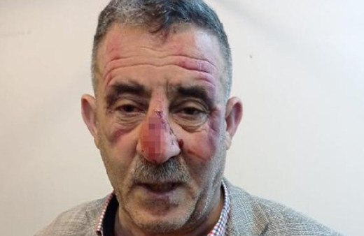 Ağrı'da randevusuz sıra almaya geldi! Memura dehşeti yaşattı