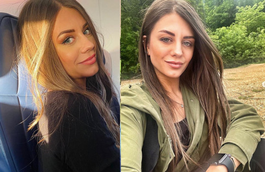 Masterchef Pelin estetiksiz eski hali nasılsı Pelin Zaman estetikleri