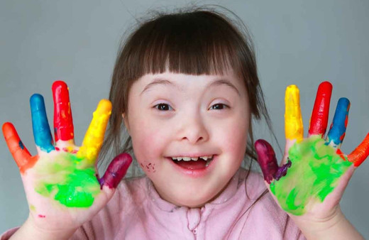 Yargıtay'dan down sendromlu çocuk kararı! Tazminat sebebi