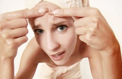 Yüzümüzdeki sivilcelerin nedenleri nelerdir hastalık habercisi olabilir!