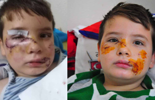 Manisa'da evinin önünde oynayan çocuğa köpek saldırdı 60 dikiş atıldı