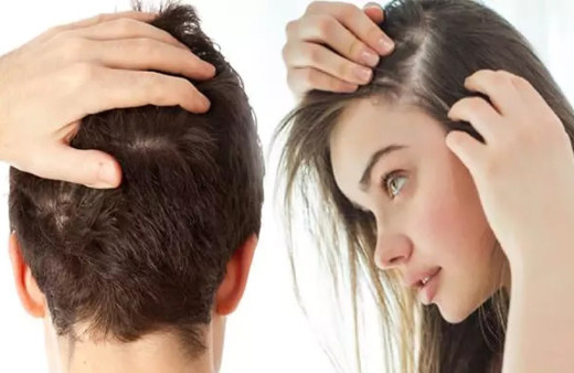 Saçınız dökülüyorsa dikkat! Uzman isim uyardı: Kulak arkası gibi...