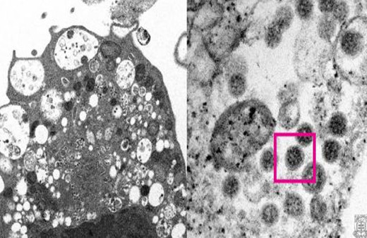 Yeni kabus! Omicron varyantının elektron mikroskobu görüntüsü yayınlandı