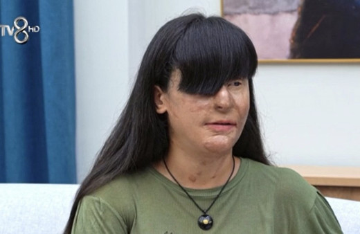 Berfin Özek olayı nedir Berfin Özek kaç yaşında eski ve son hali nasıl?