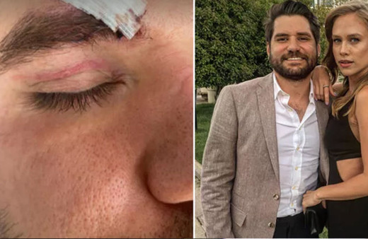 TRT1 Seksenler'in Şahin'i Ceyhun Fersoy'a gittiği mekanda saldırı! Darp edildi