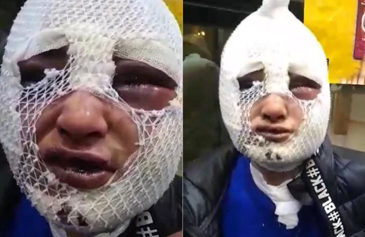 Hatay'da eski sevgili dehşeti! Evini basıp tecavüz etti sonra da başından aşağı kızgın yağ döktü