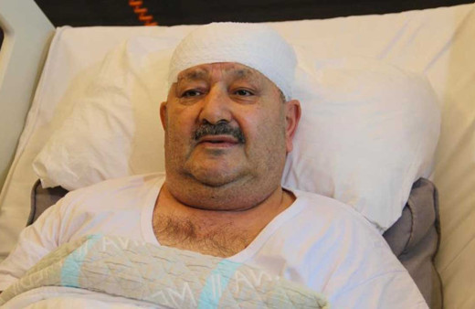 Diş ağrısı sanıp 6 sağlam dişini çektirdi, meğer gerçek bambaşka çıktı