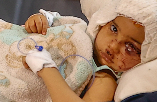 Gaziantep'te pitbull saldırısında yaralanan Asiye için Bakan Koca dünyaca ünlü o hekimimizi aradı