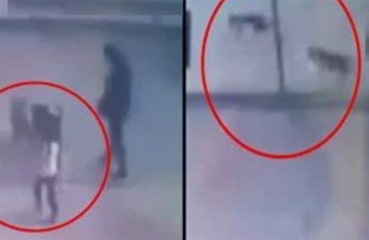 Gaziantep'te küçük çocuğun yaralandığı pitbull saldırısında yeni görüntüler ortaya çıktı