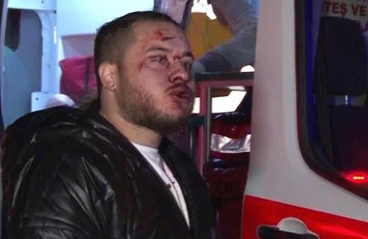 Çekmeköy’de kazada yaralanan yolcudan ilginç diyalog