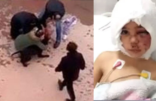 Minik Asiye'ye pittbul saldırısının ardından köpeklerin toplanmasına ünlülerden Twitter'da 'hayvanıma dokunma' tepkisi