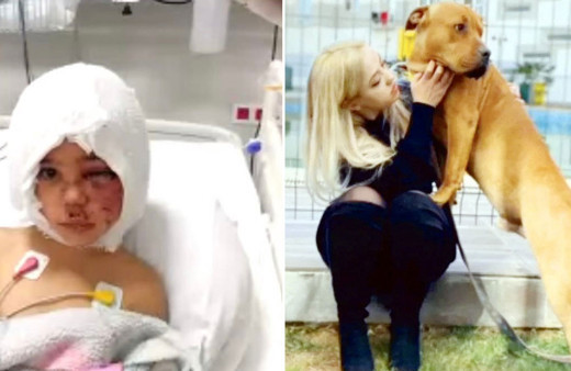 Pitbull saldırısında güvenlik kamera kayıtlarıyla ilgili gerçek ortaya çıktı