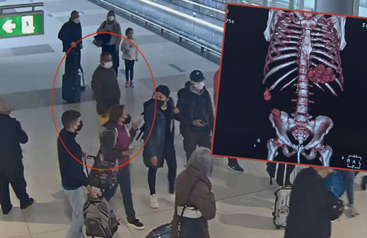 İstanbul Havalimanı'nda uyuşturucu kuryesi bayılınca yakalandı