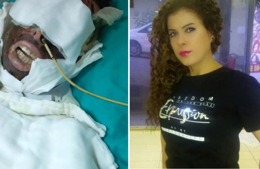 Yüzü kemiklerine kadar eriyen kadının görüntüsü dehşete düşürdü sapık için istenen ceza belli oldu