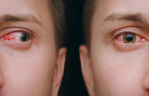 Omicron'un iki yeni garip semptomu daha ortaya çıktı