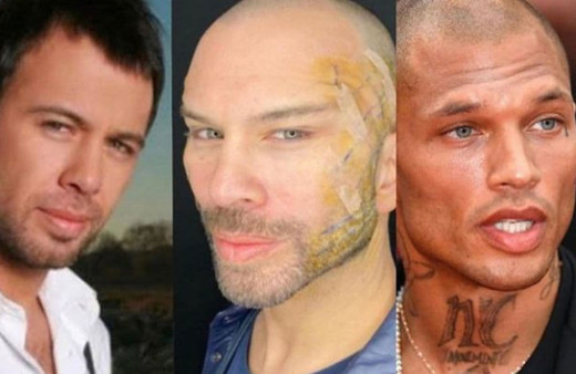 Berksan'ın son hali inanılmaz estetik ameliyat geçirdi! Jeremy Meeks'in kopyası!