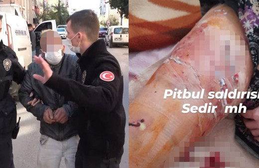 Antalya'da pitbull dehşeti! Bacağı kesilebilir