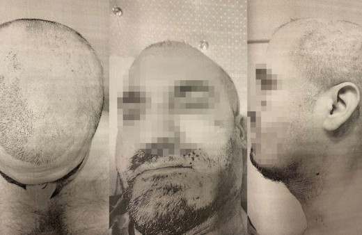 Öğrenci yurdunda akıl almaz işkence! Bağlayıp sakallarını ve saçlarını sıcak ağda ile kökünden söktüler