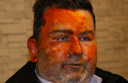 Sakarya'da dehşeti yaşadı! Can havliyle uykusundan uyandı yüzü tanınmaz hale geldi