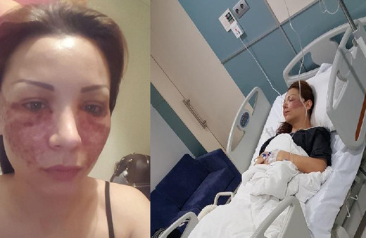 Bulgar modelin estetik kabusu! Kuaför kardeşler: Örümcek ağı yapmadık, iftira