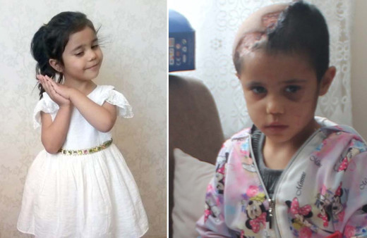 Asiye'nin yeni evindeki son haline bakın! Pitbull vahşetini gözler önüne serdi