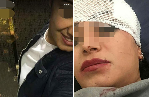 Pavyonda eski eşiyle gördüğü arkadaşının yüzünü jiletle kesti! '76 günün acısı kötü olacak'