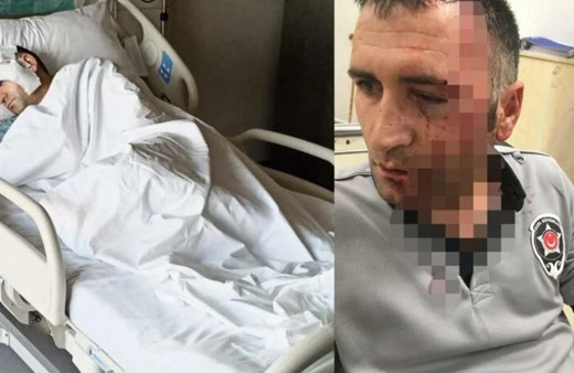 İstanbul'da taş dolu poşetle banka güvenliğine saldırdı! Kanlar içinde bıraktı