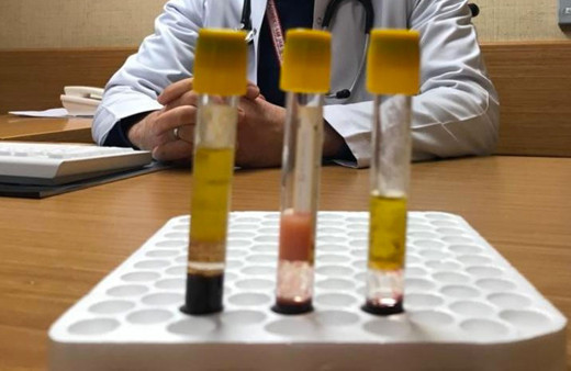 Kolesterolün önemi kanda ortaya çıktı uzmanlar sonuçları açıkladı