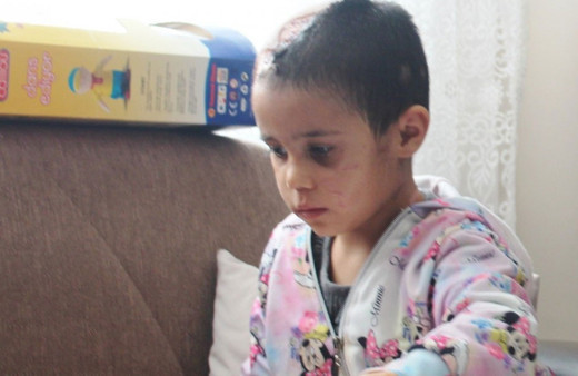 Gaziantep'te Asiye Ateş’in pitbull saldırısına uğramasına ilişkin davada 4 tahliye