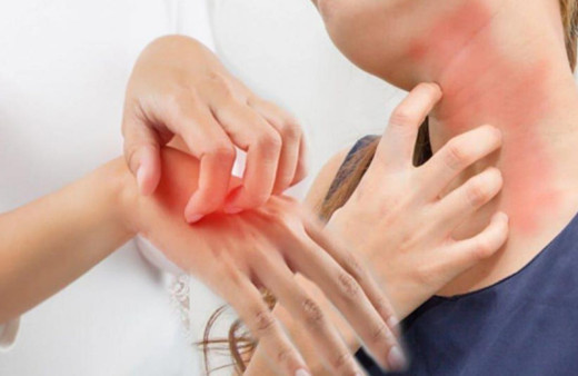 Geceleri uyutmayan kaşıntının nedeni bakın ne! Uzman için açıkladı: Acilen...