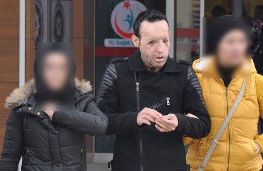 Yüz nakli yapılan Recep Sert gözaltına alındı