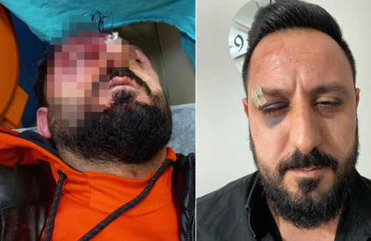 İstanbul'da o soruyu sorunca öldüresiye dayak yedi! Komşuları üstünden geçti: Dakikalarca kendine gelemedi