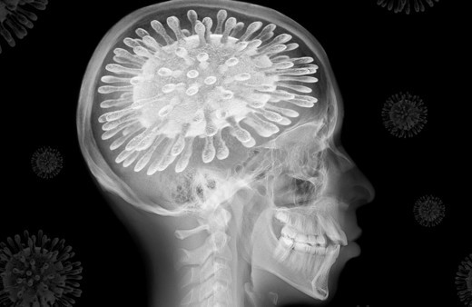 Merak edilen soruya yanıt! Koronavirüs beyinde kalıcı etki bırakıyor mu?