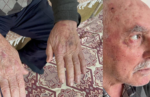 İETT şoföründen bayıltan dayak! 75 yaşındaki adam neye uğradığını şaşırdı