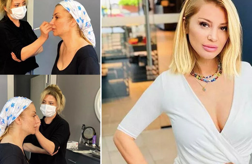 Gören bu Songül Karlı mı dedi! Estetik yaptırdı bambaşka yüzü oldu