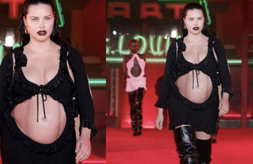 Doğuma gün sayan Adriana Lima'nın göbeğini gören şaştı kaldı! Karın kası mı operasyon mu?