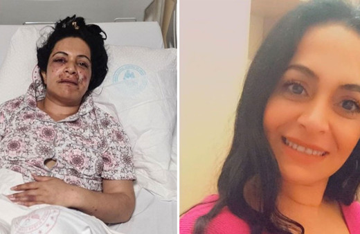 İstanbul Sarıyer'de iki elti arasındaki kıskançlık kavgası kanlı bitti güzel diye ağzından vurdu