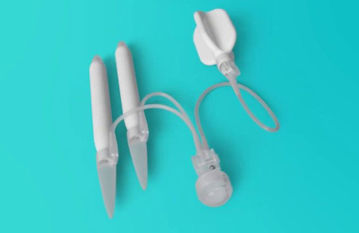 Doktor malzeme yok diye farklı yöntem uyguladı mutluluk çubuğu kabusa döndü!